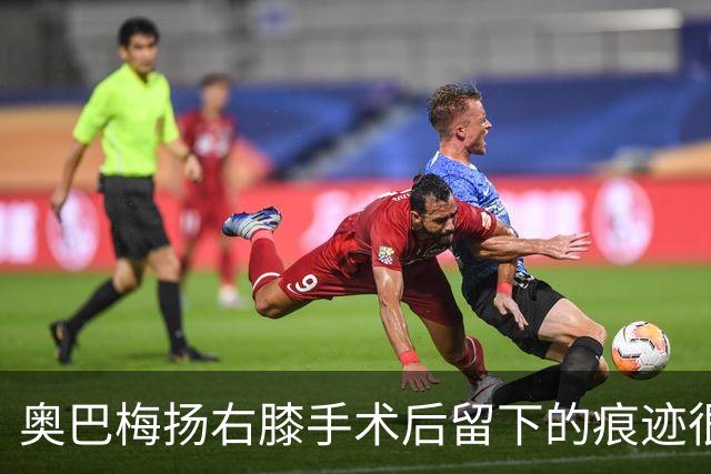 奥巴梅扬右膝手术后留下的痕迹很小，膝盖纹有魔人布欧